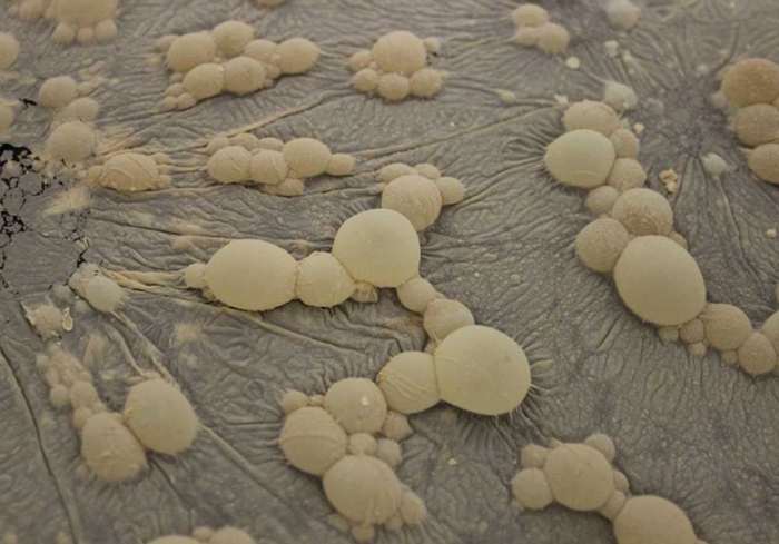 ڕۆڵی قەتماغەی میکرۆبی لە کلۆربوونی ددان