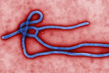 ڤایرۆسی ئیبۆلا