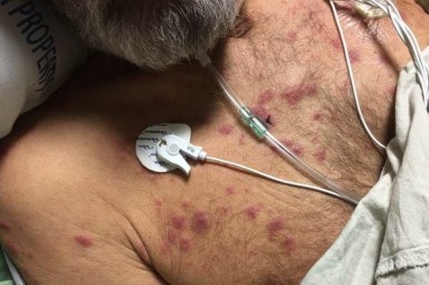 کۆنیشانەی تێكچوونی گەشەی مۆخی ئێسک