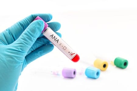 پشکنینی ئەی ئێن ئەی (ANA)